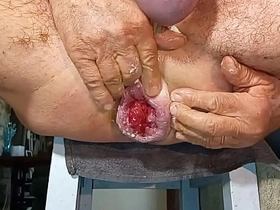 扩肛侠2025-14 asian gay honeymoon sex videos