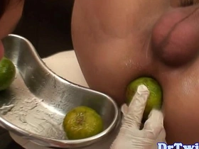 大号假阳具检查亚洲嫩鸡前列腺 all asian gay sex videos download